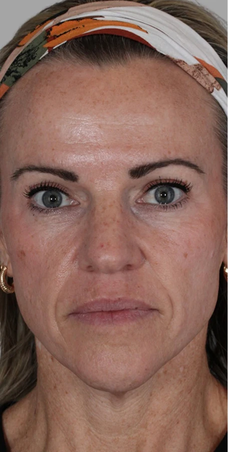 Real Patient Results by Harry Ching MD, in Las Vegas, NV.