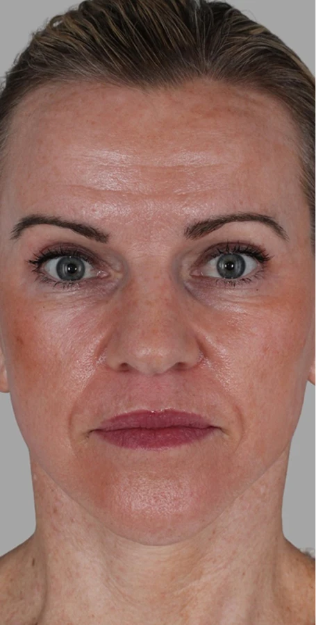Real Patient Results by Harry Ching MD, in Las Vegas, NV.