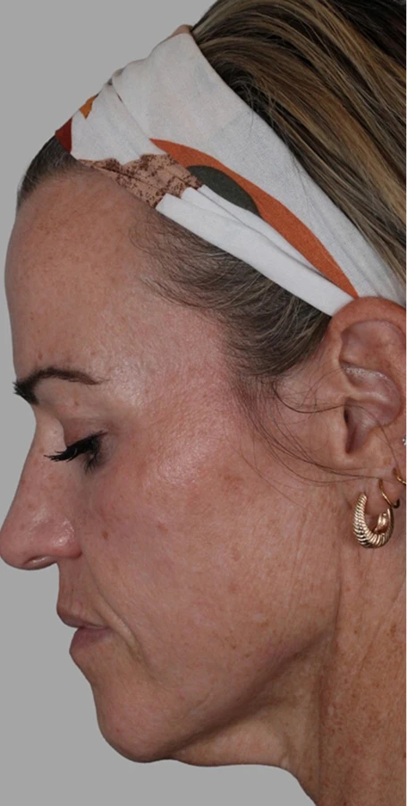Real Patient Results by Harry Ching MD, in Las Vegas, NV.