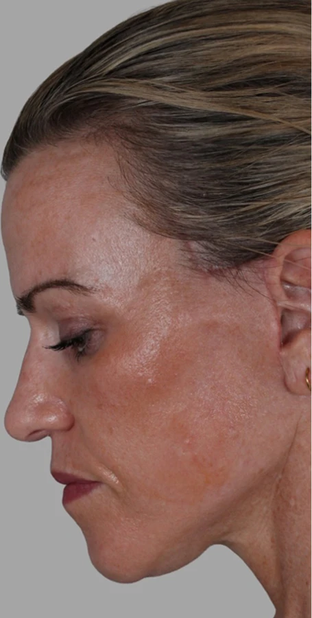 Real Patient Results by Harry Ching MD, in Las Vegas, NV.